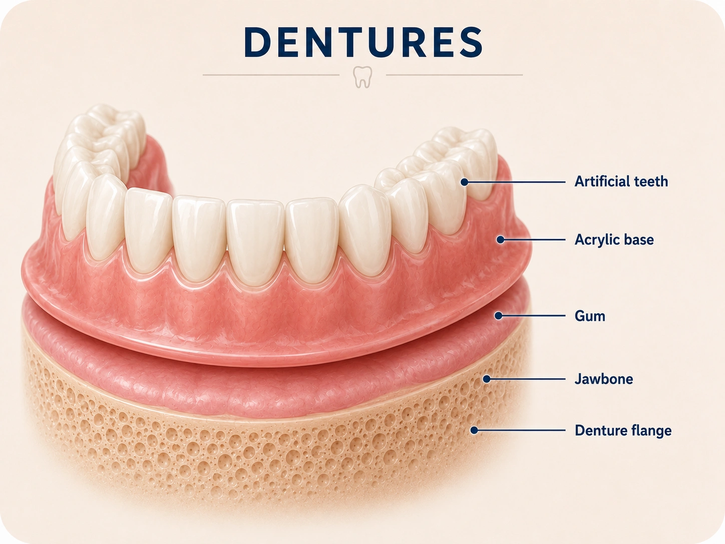 Dentures (बनावटी दात) secondary