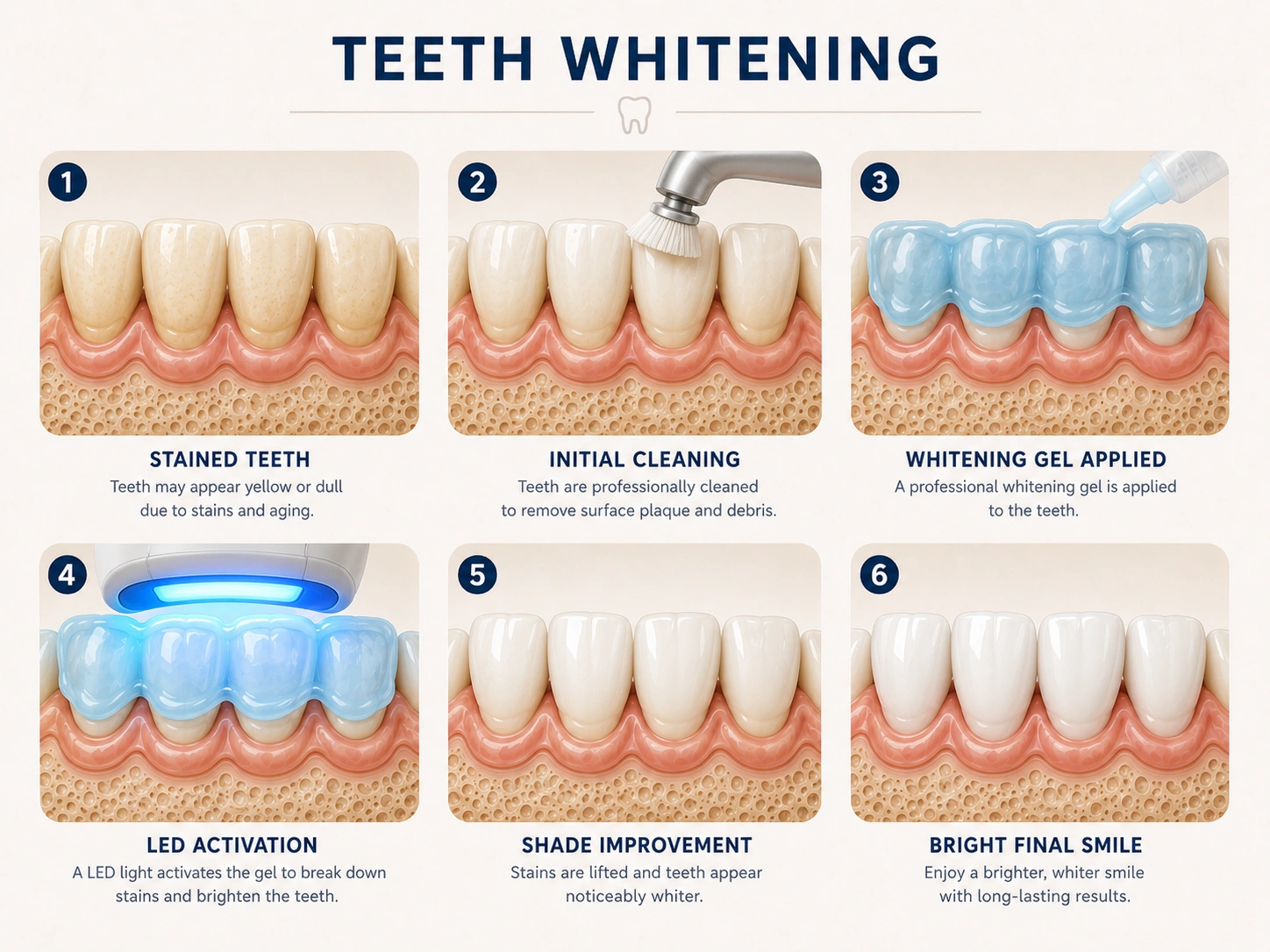Smile Makeover & Teeth Whitening (स्माईल मेकओव्हर आणि दात पांढरे करणे) main